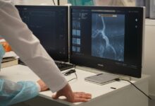 Photo of Помощь нуждающимся: как начать